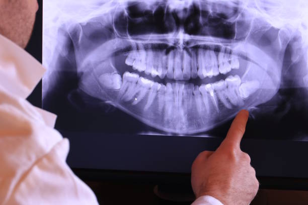 Best Emergency Dental Care for Trauma or Injury in Bradford, RI